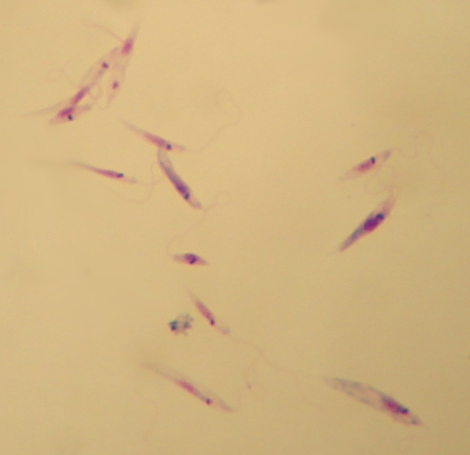 Leishmania tropica