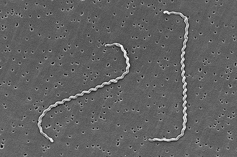 Leptospira interrogans