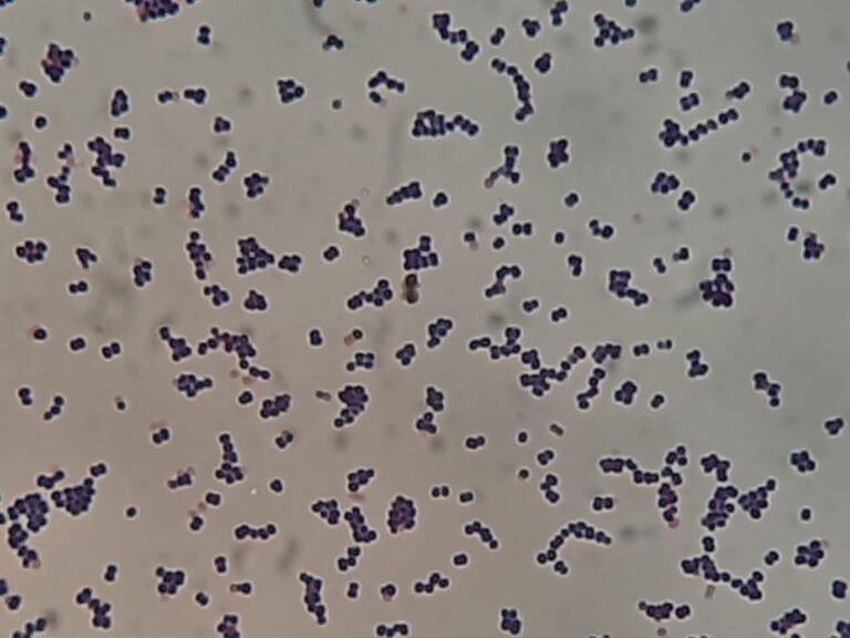 Leuconostoc mesenteroides