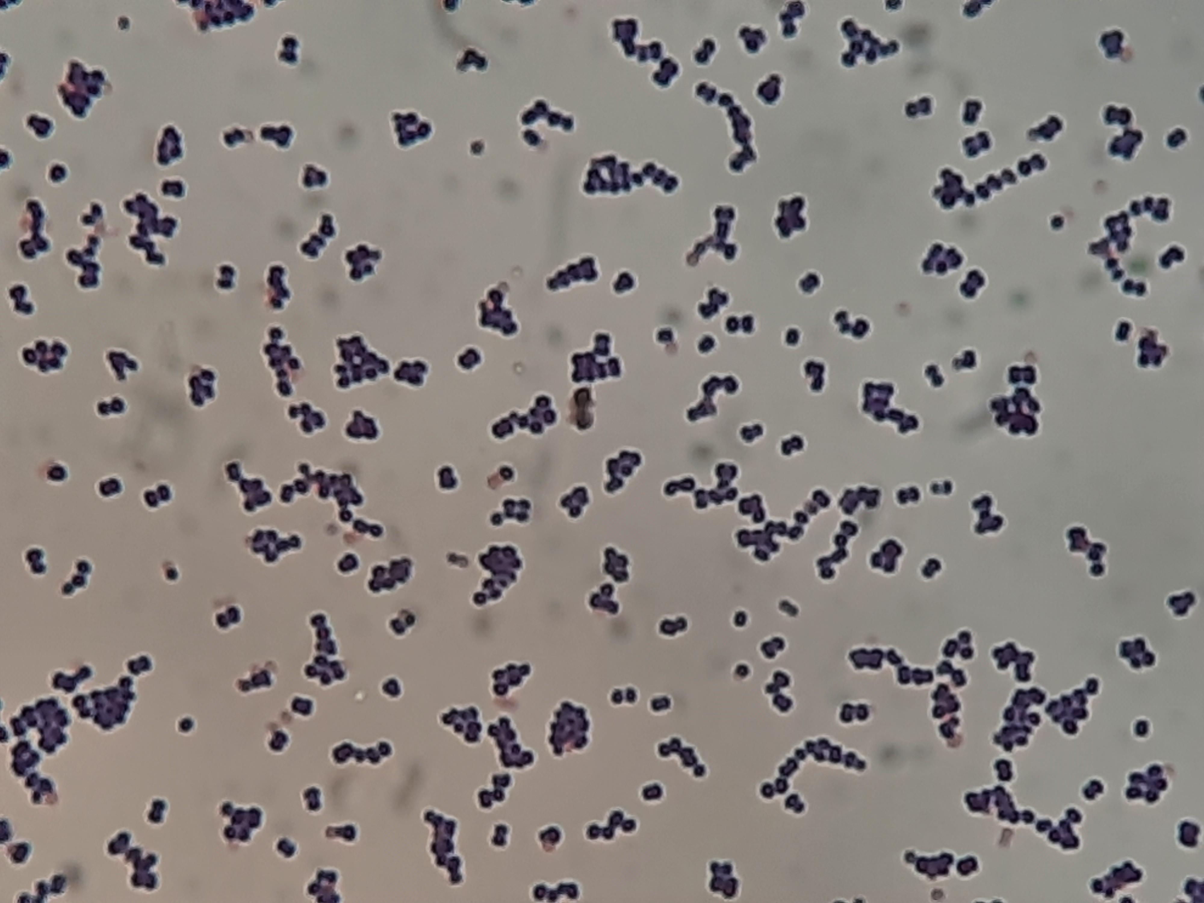 Leuconostoc mesenteroides