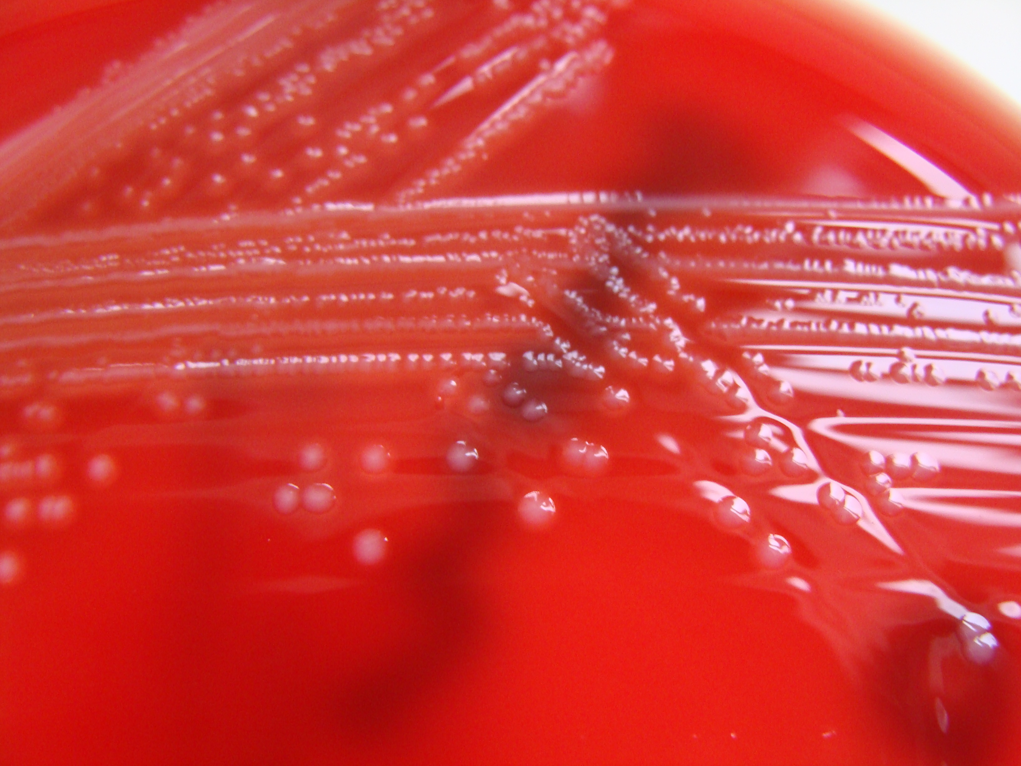 Listeria monocytogenes