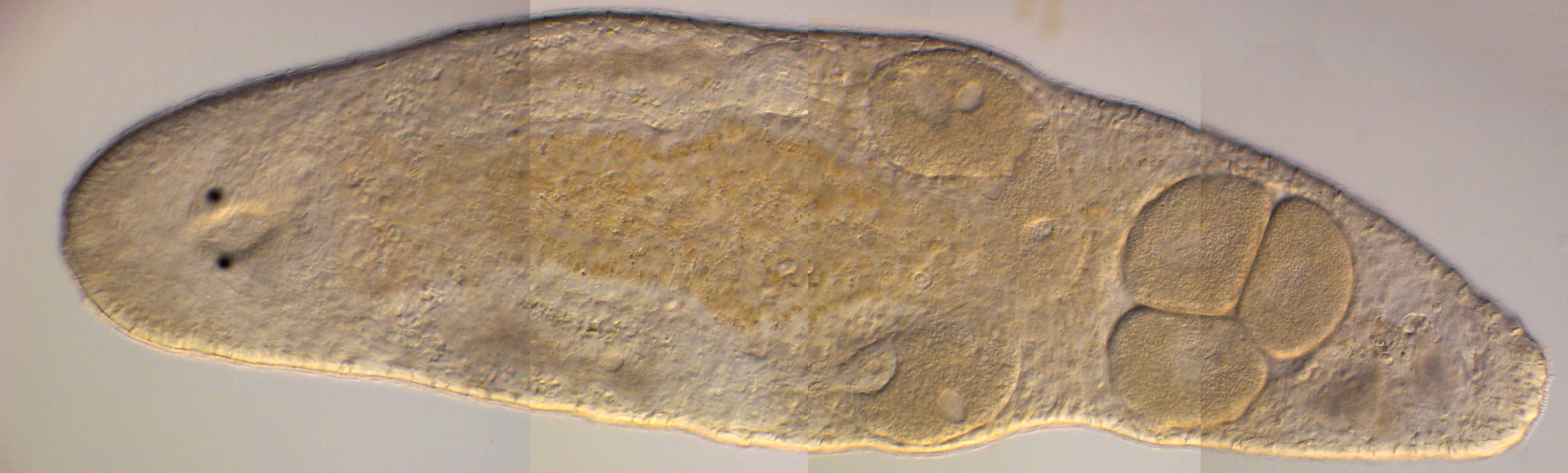 Macrostomum hystrix