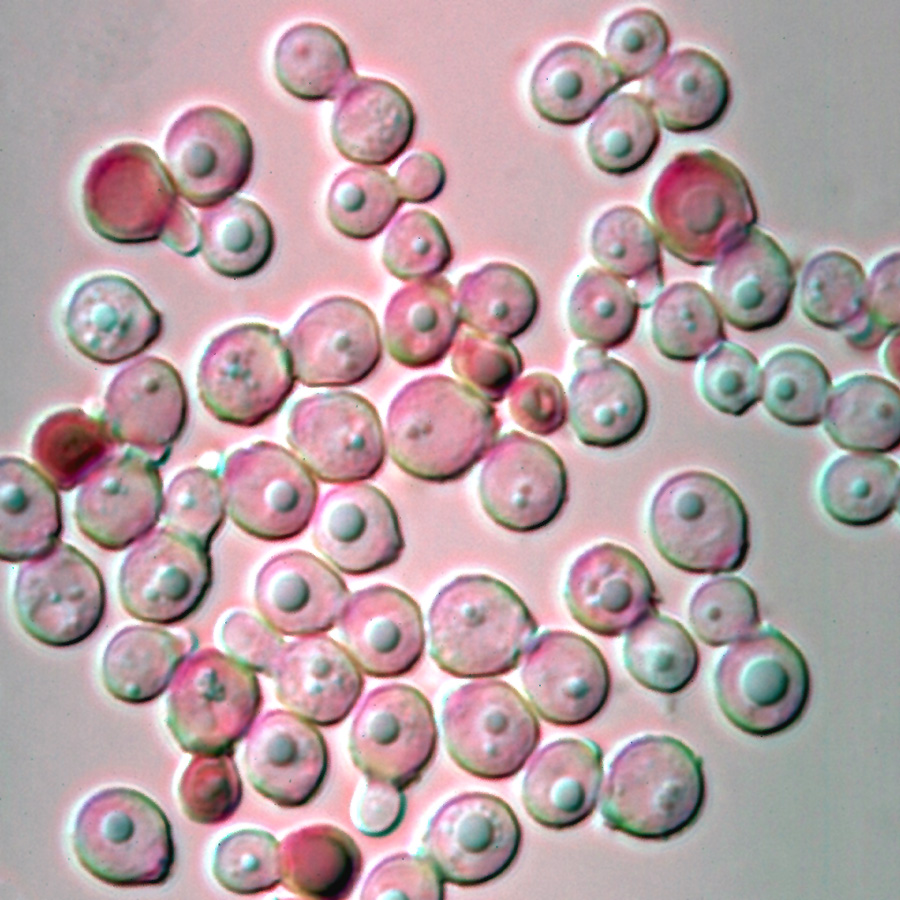 Malassezia globosa