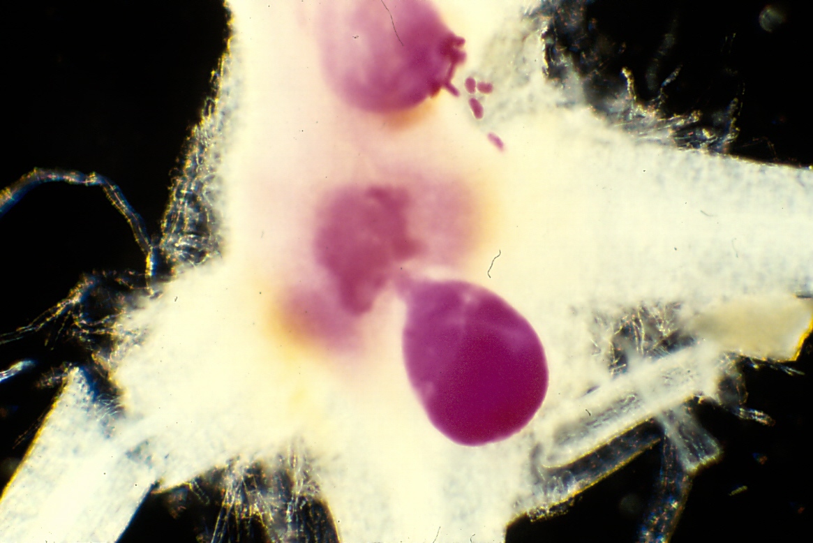 Meloidogyne arenaria
