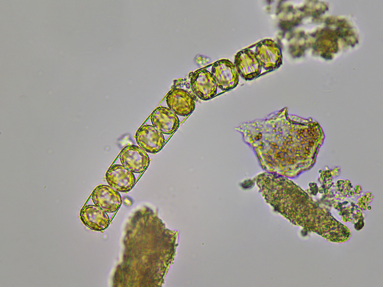 Melosira nummuloides