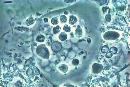 Měňavka ústní (Entamoeba gingivalis) pod mikroskopem