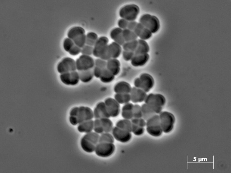 Methanosarcina barkeri