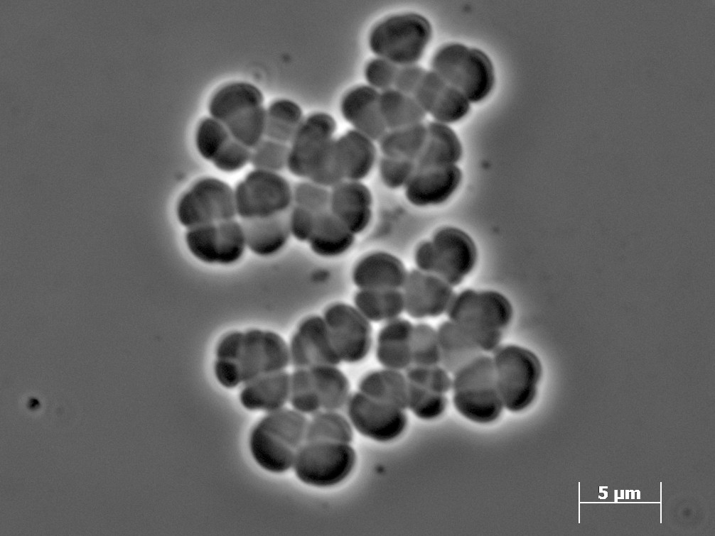 Methanosarcina barkeri