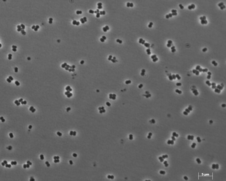 Methanosphaera stadtmanae Methanosphaera stadtmanae