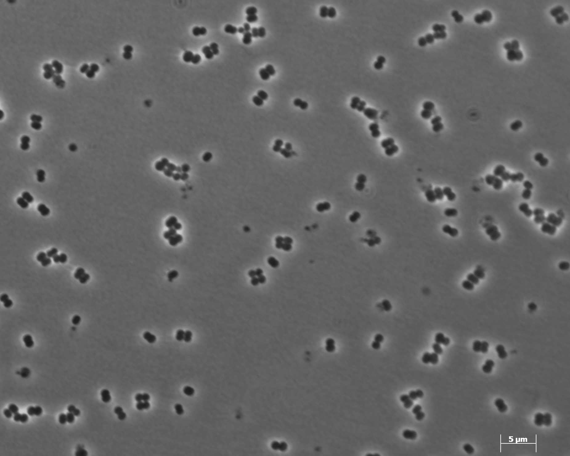 Methanosphaera stadtmanae