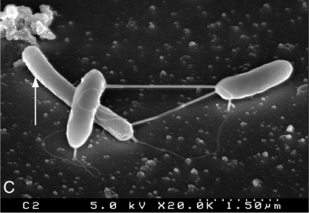 Methanothermobacter thermautotrophicus