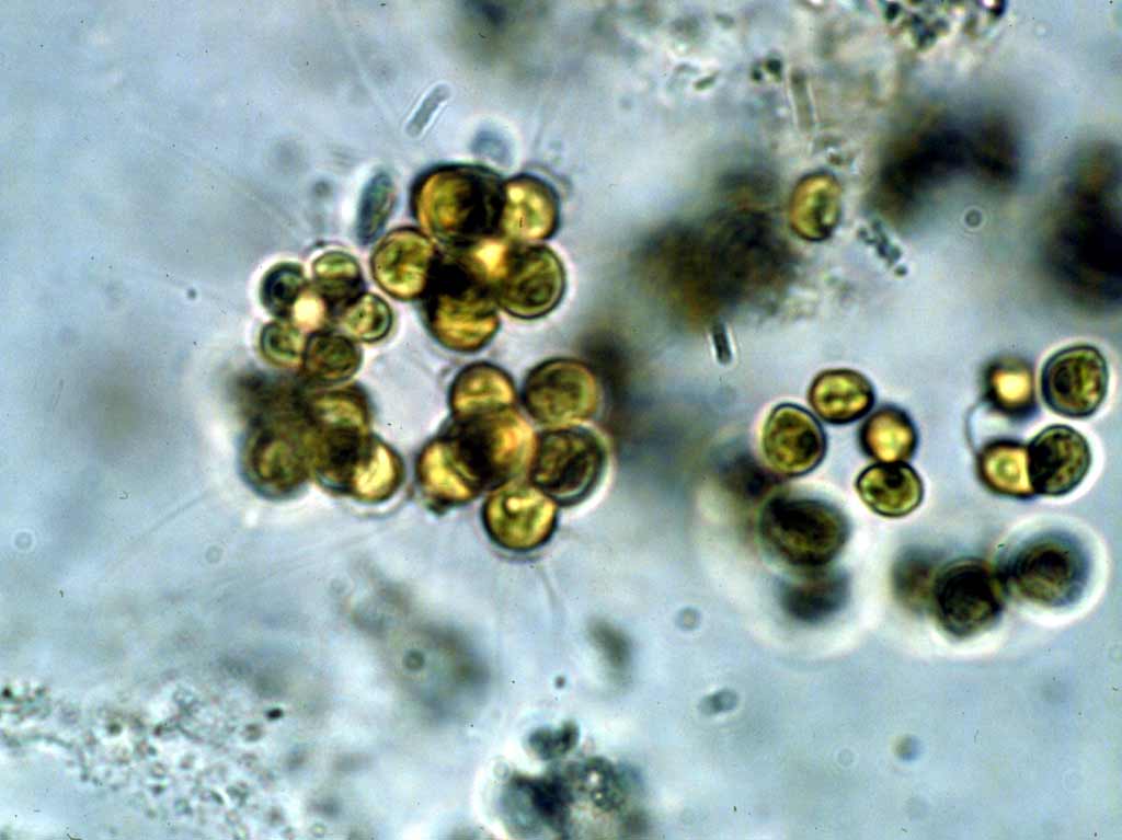 Micractinium pusillum