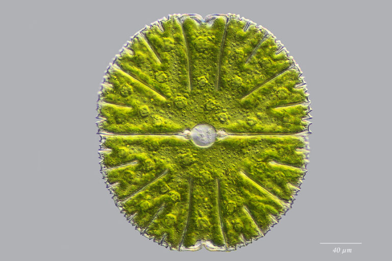 Micrasterias thomasiana