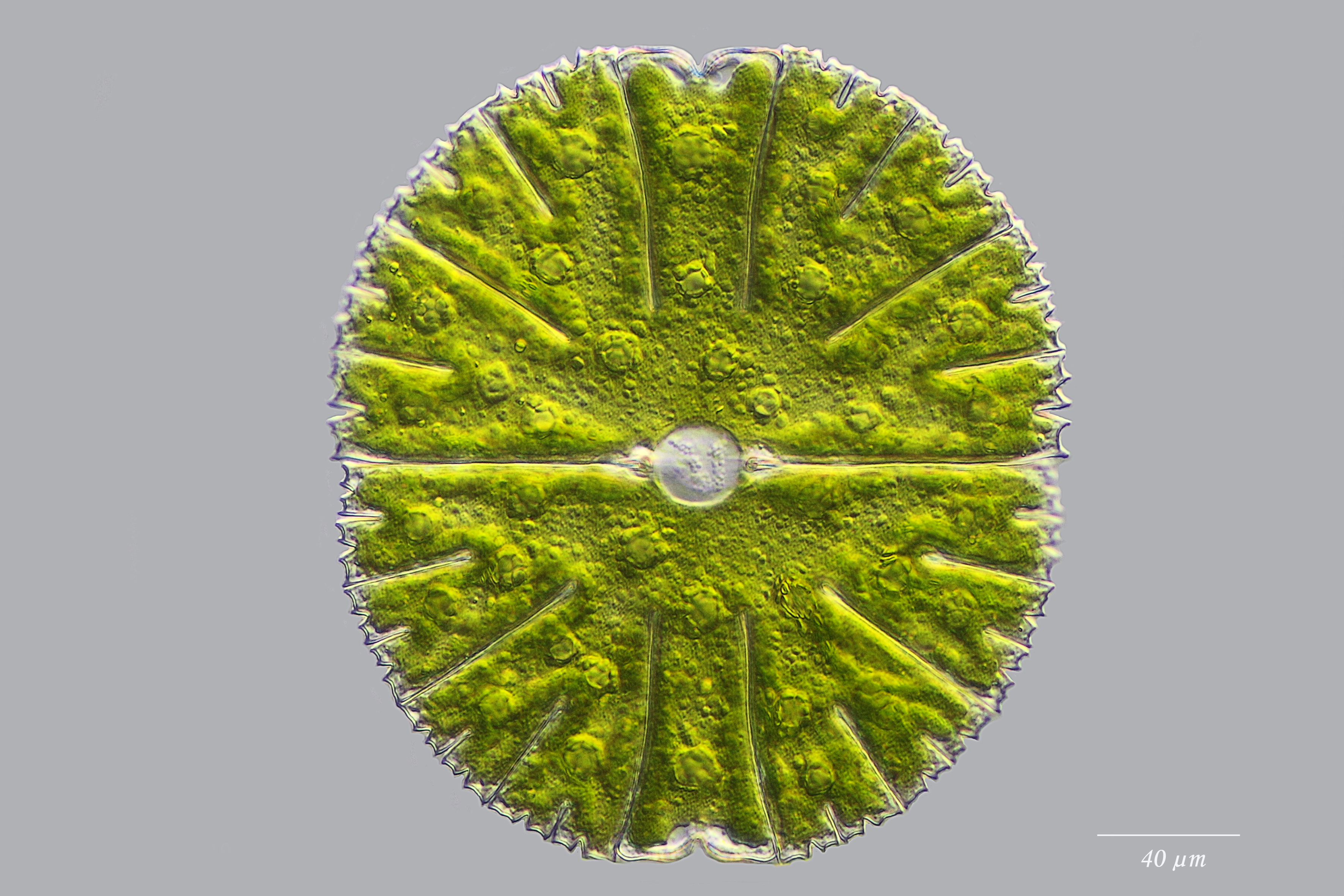 Micrasterias thomasiana
