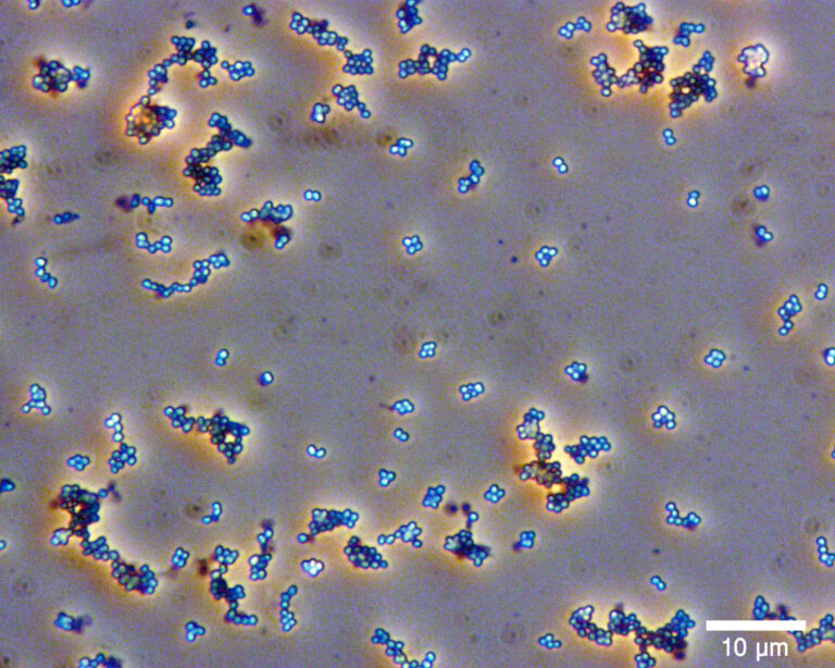 Micrococcus luteus
