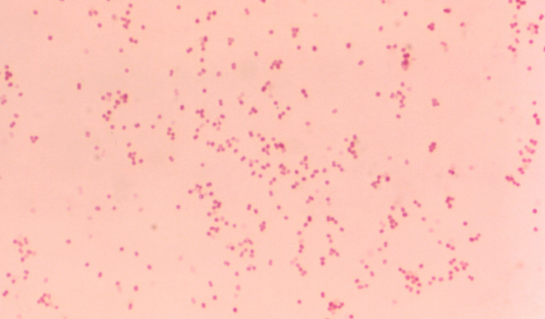 Moraxella catarrhalis