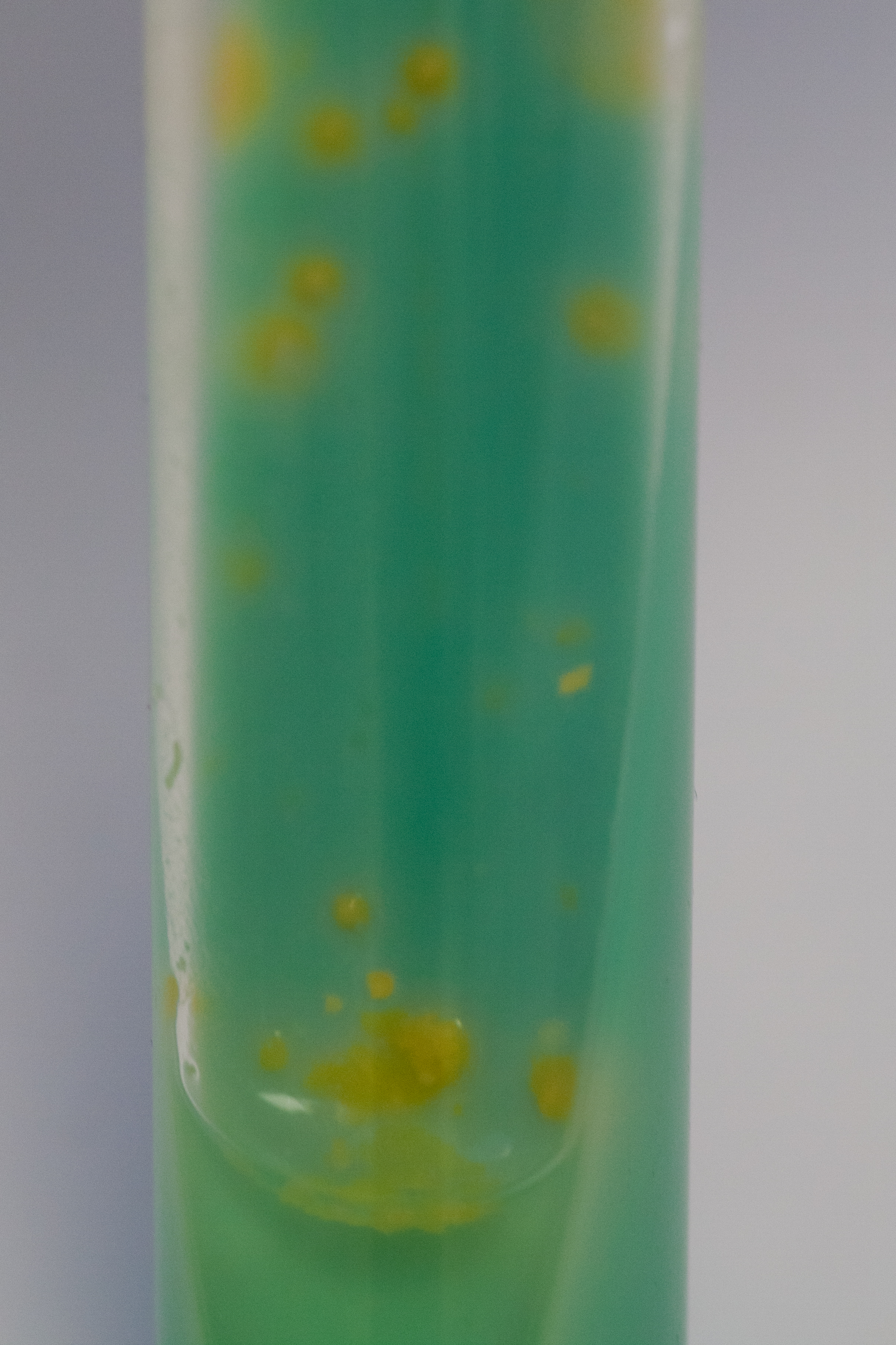 Mycobacterium kansasii