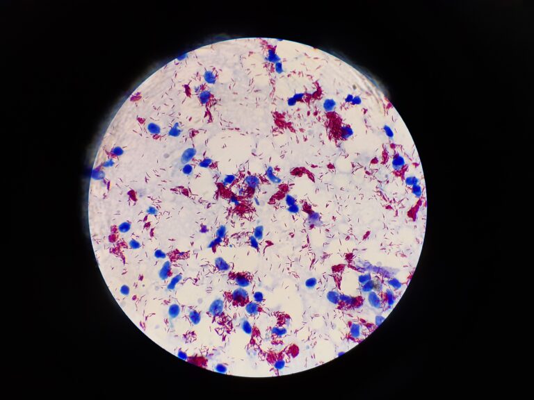 Mycobacterium leprae