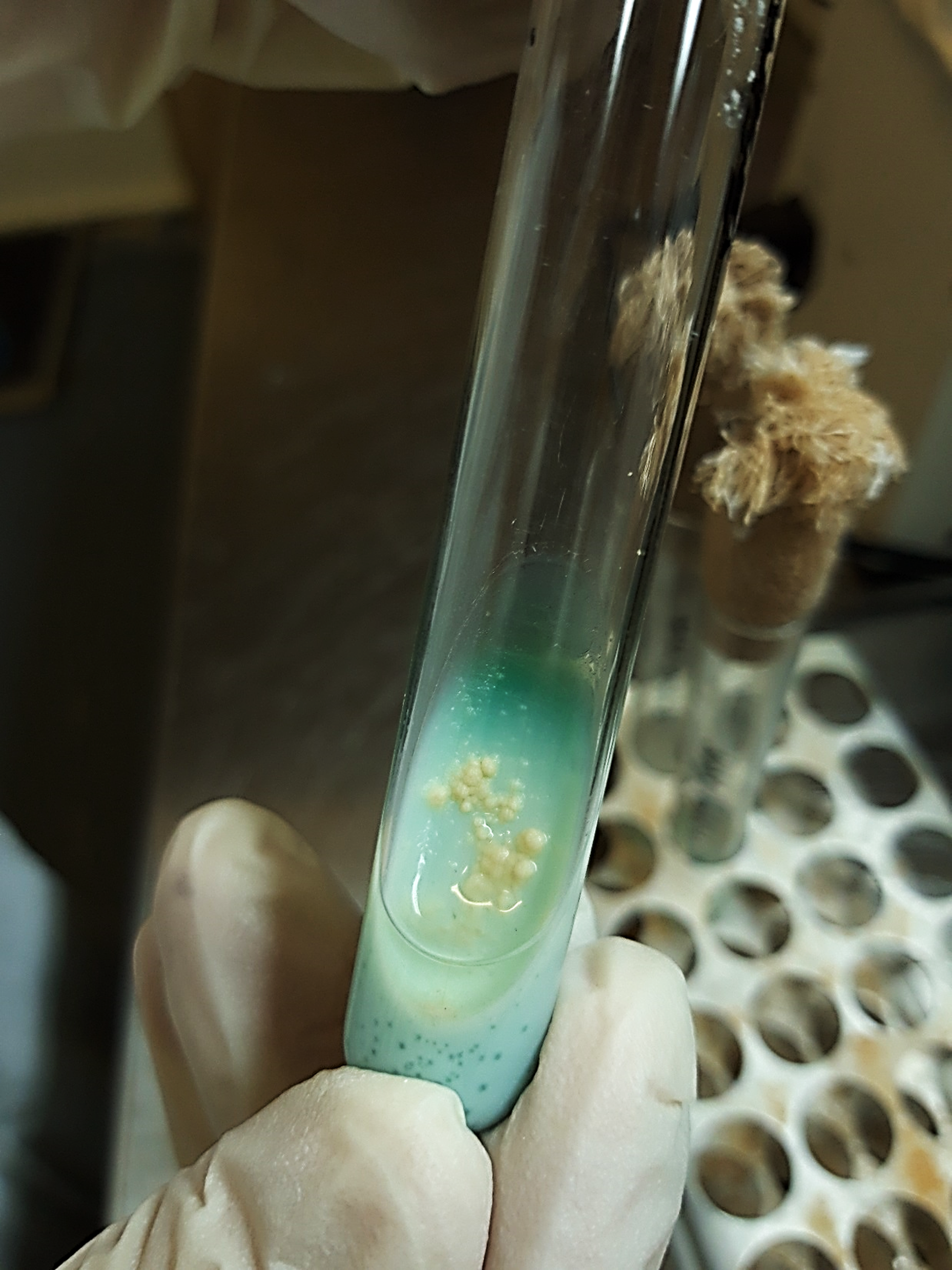 Mycobacterium tuberculosis