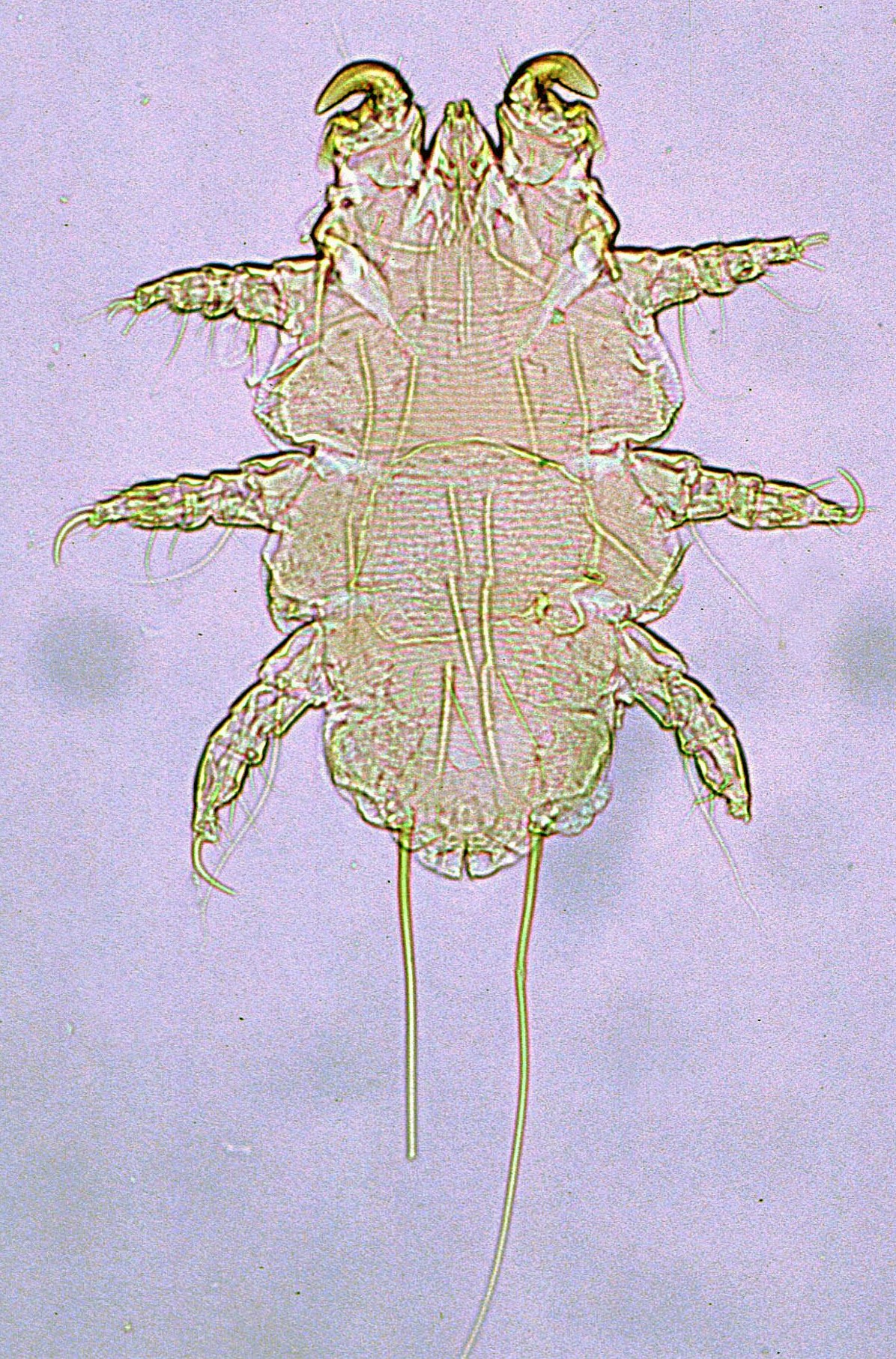 Myobia musculi