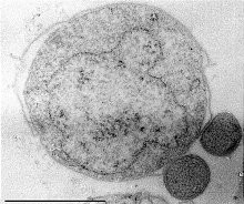 Nanoarchaeum equitans