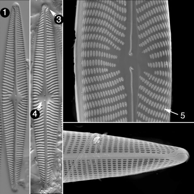 Navicula radiosa
