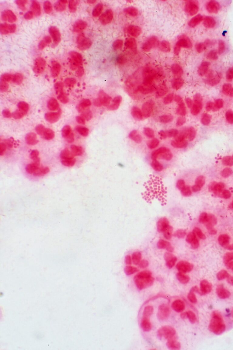 Neisseria gonorrhoeae