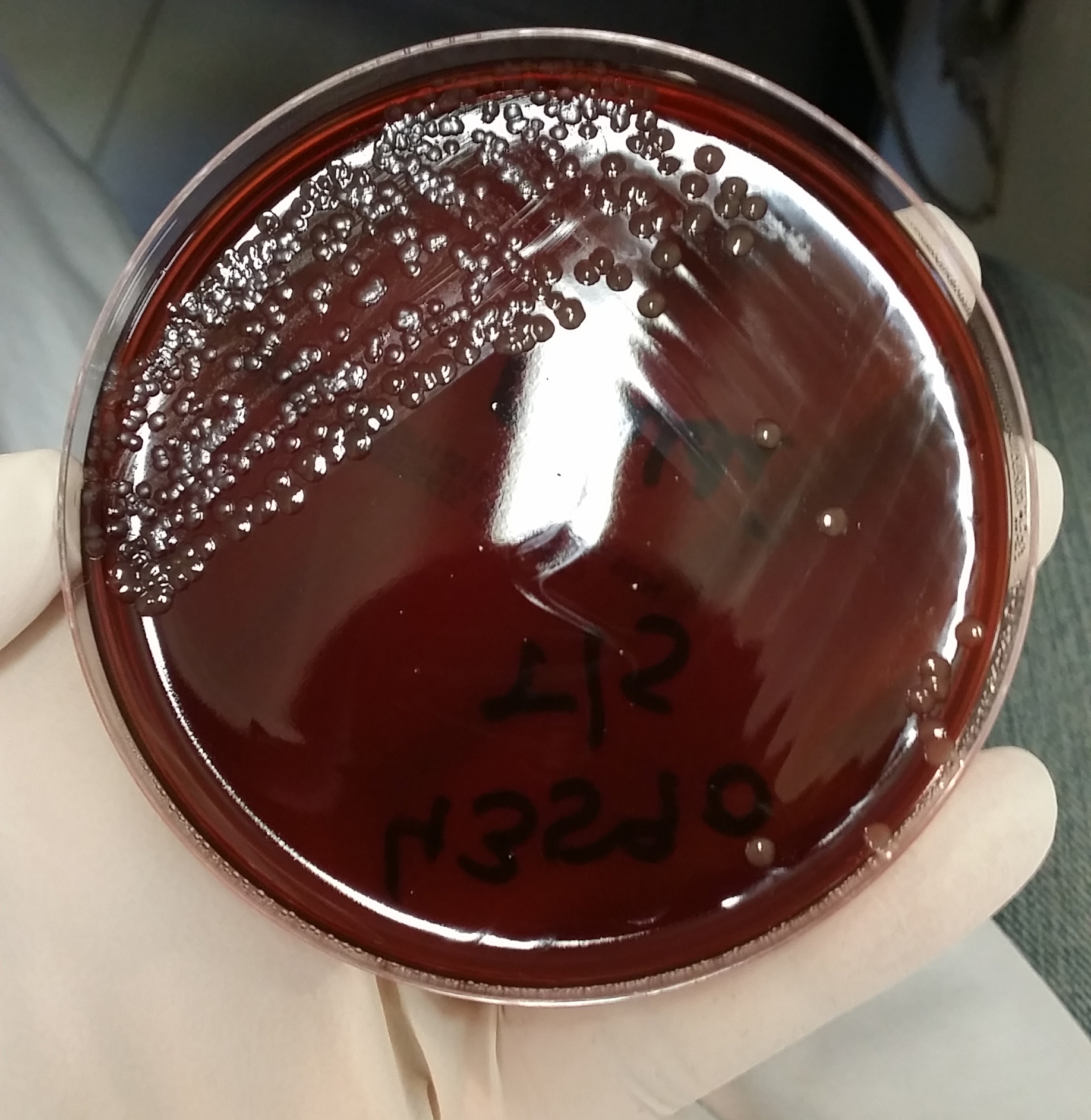 Neisseria meningitidis
