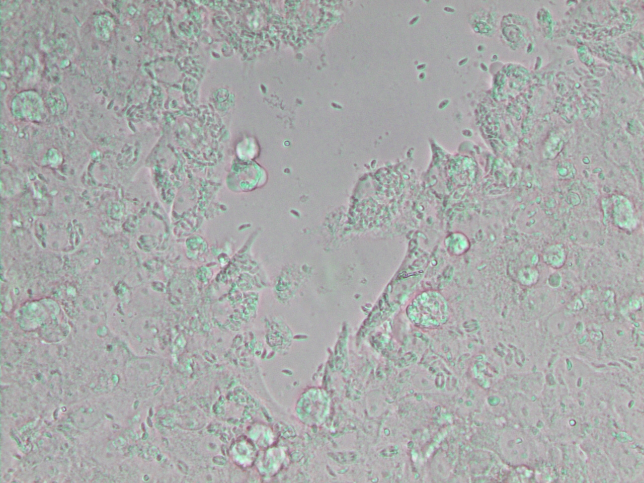 Neospora caninum