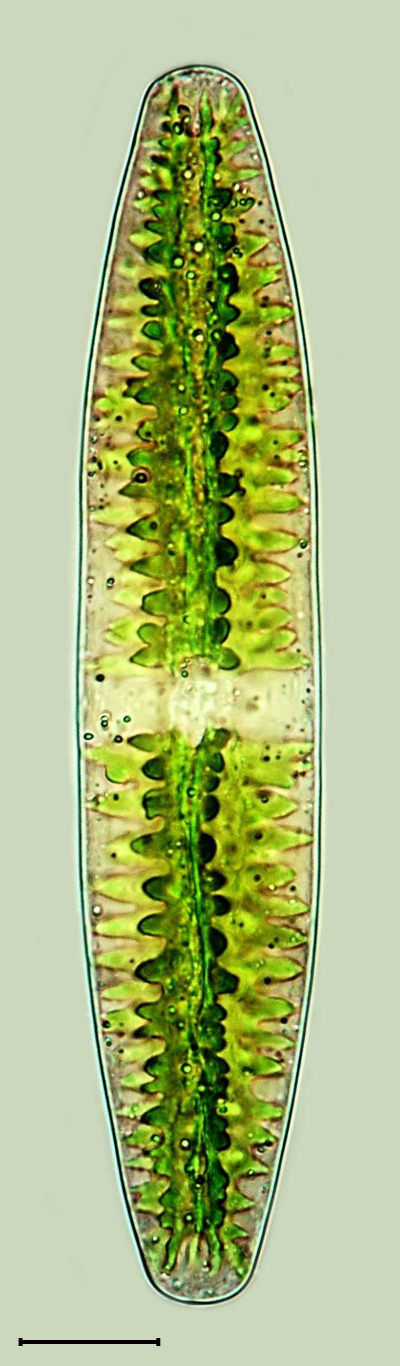 Netrium digitus