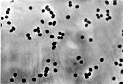 Nitrosomonas europaea