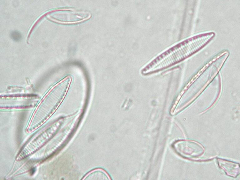 Nitzschia amphibia Nitzschia amphibia