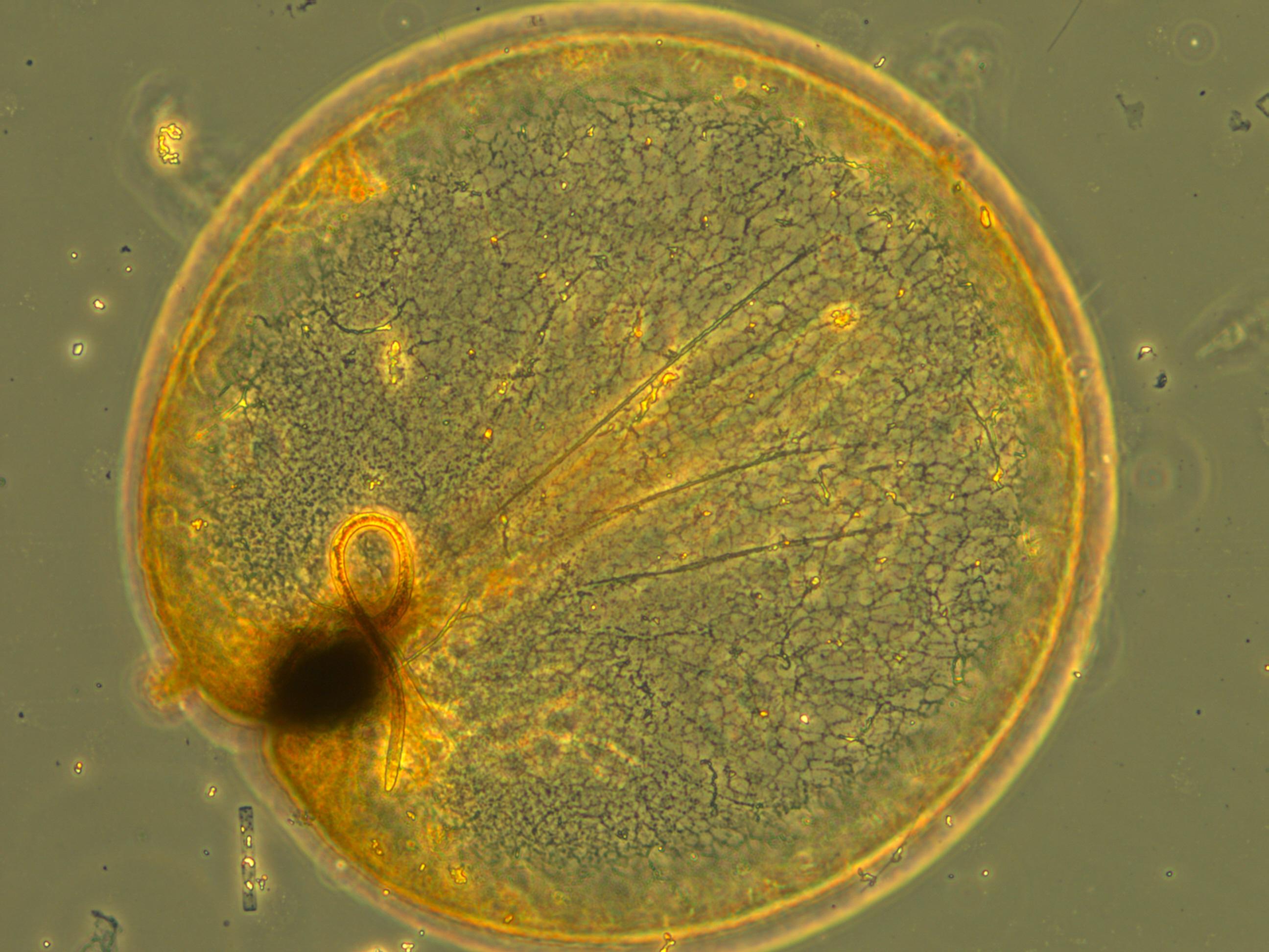 Noctiluca scintillans