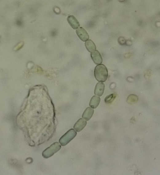 Nostoc azollae