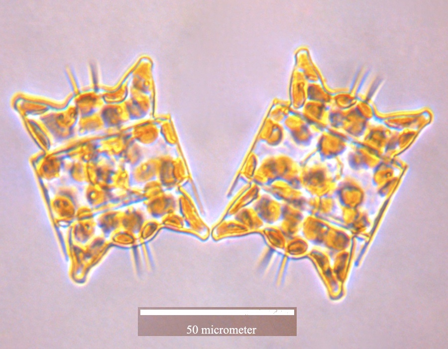 Odontella aurita