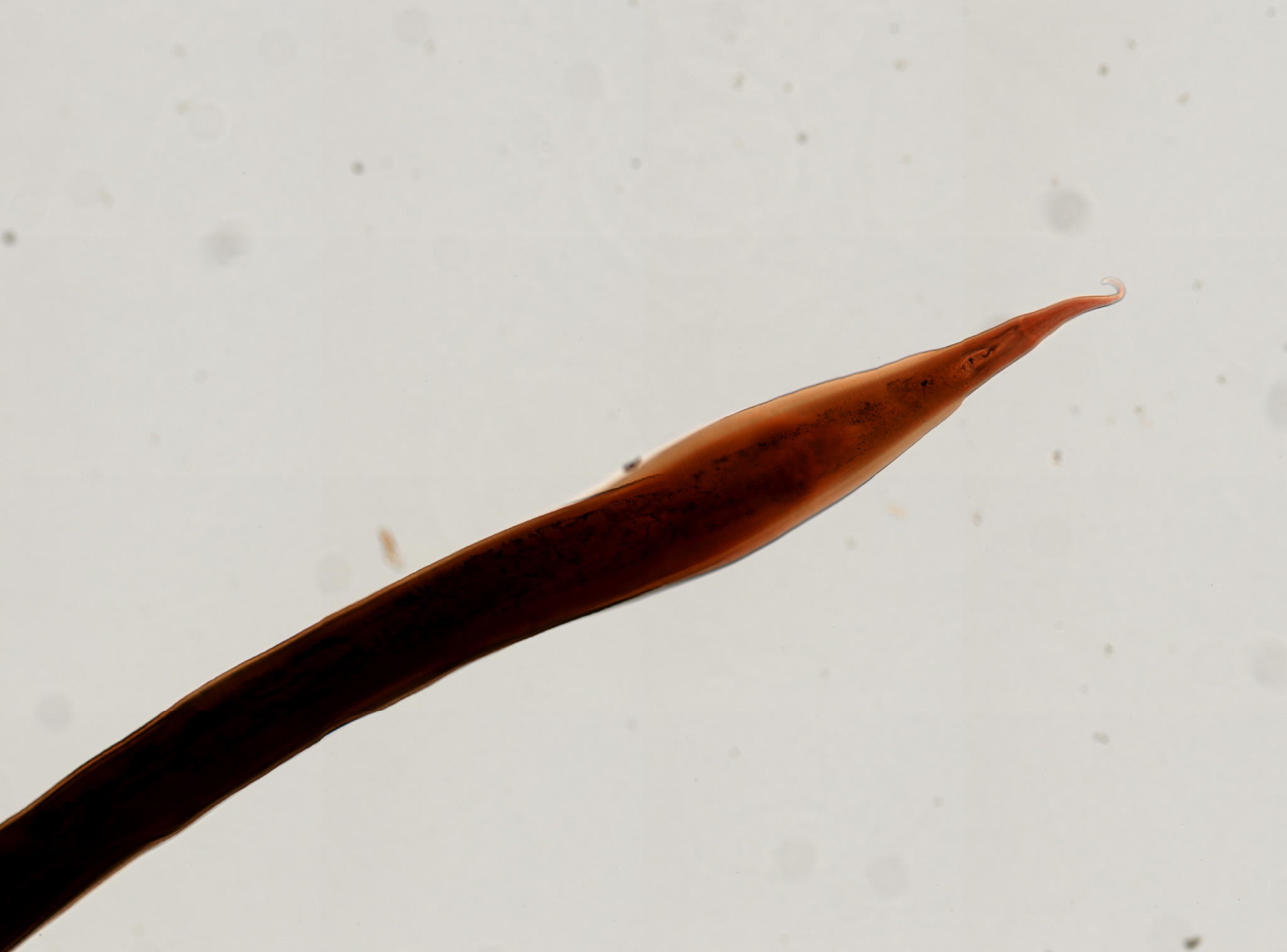 Oesophagostomum columbianum
