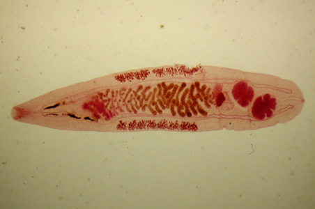 Opisthorchis felineus