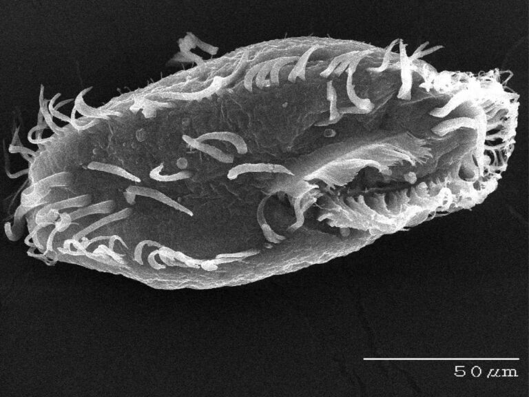 Oxytricha trifallax