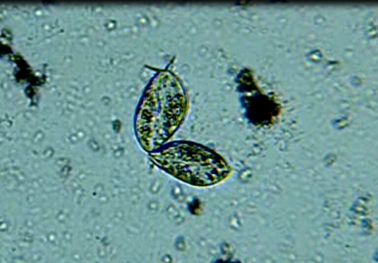Paramecium aurelia