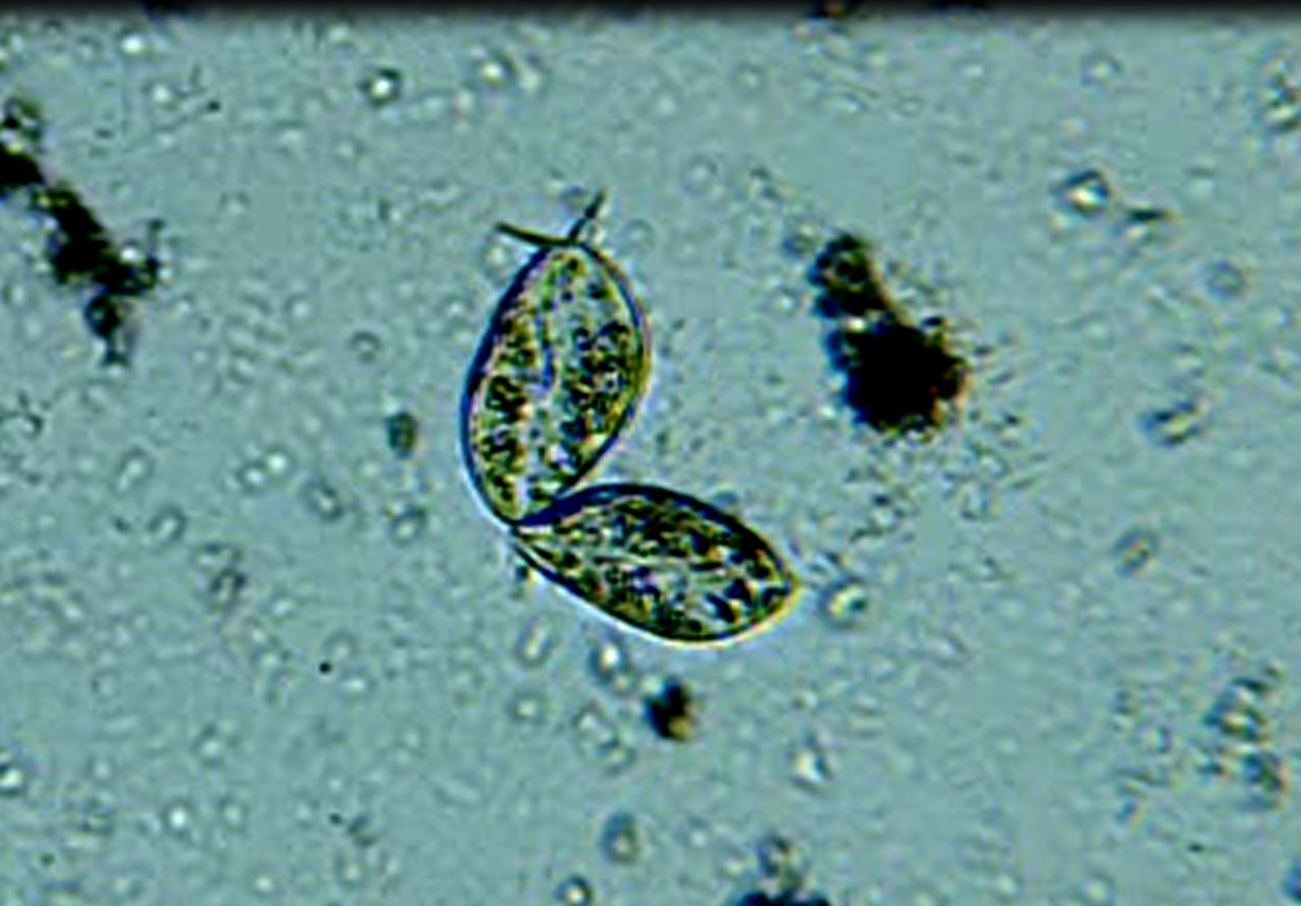 Paramecium aurelia