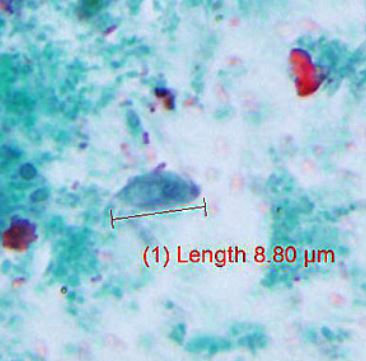Pentatrichomonas hominis