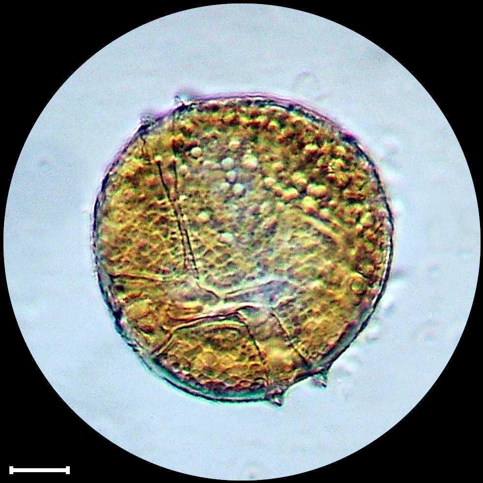 Peridinium cinctum