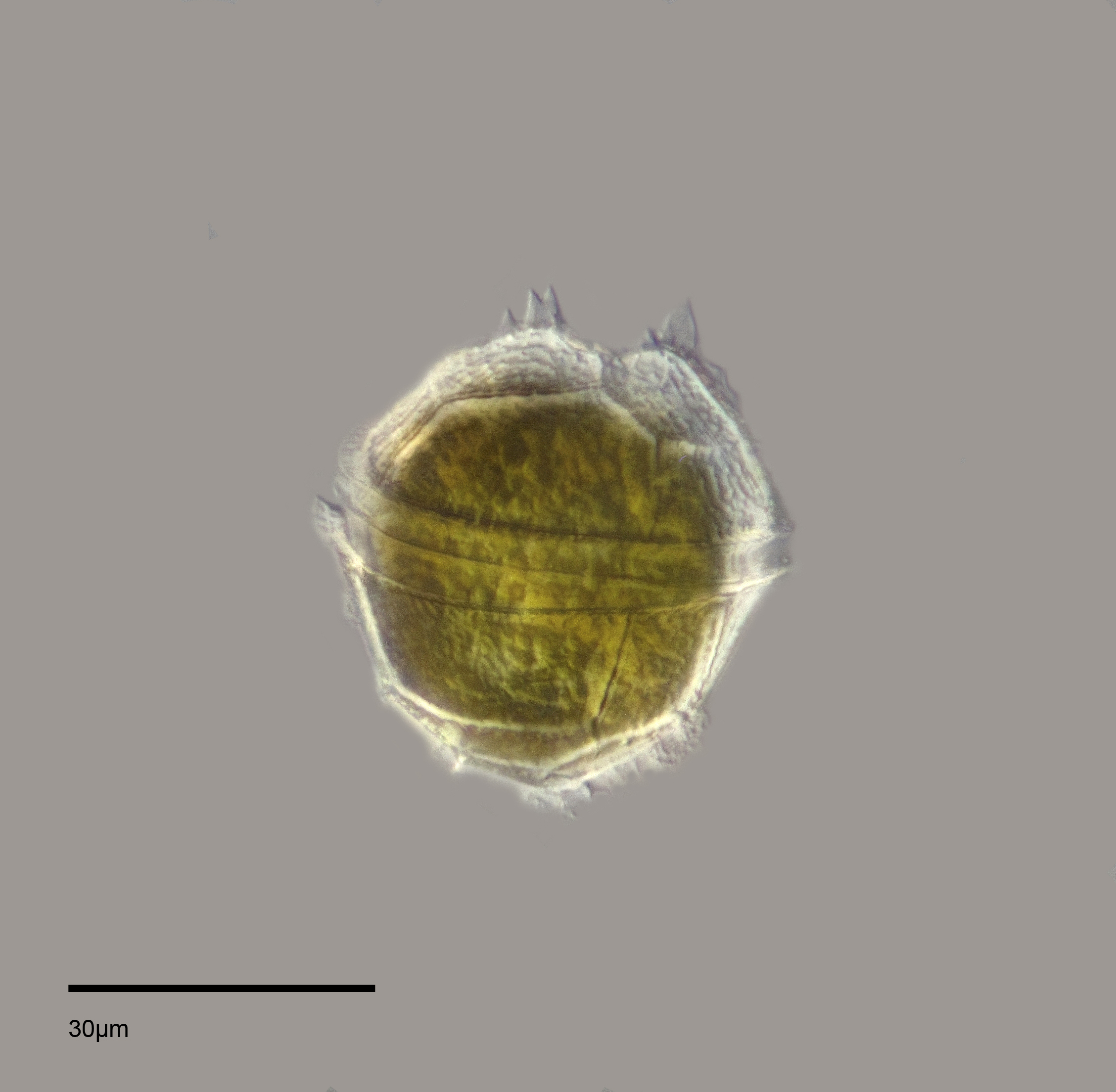 Peridinium willei