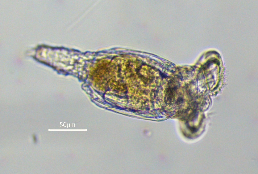 Philodina megalotrocha