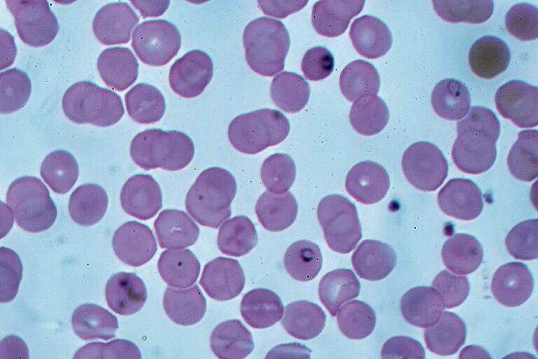 Plasmodium falciparum