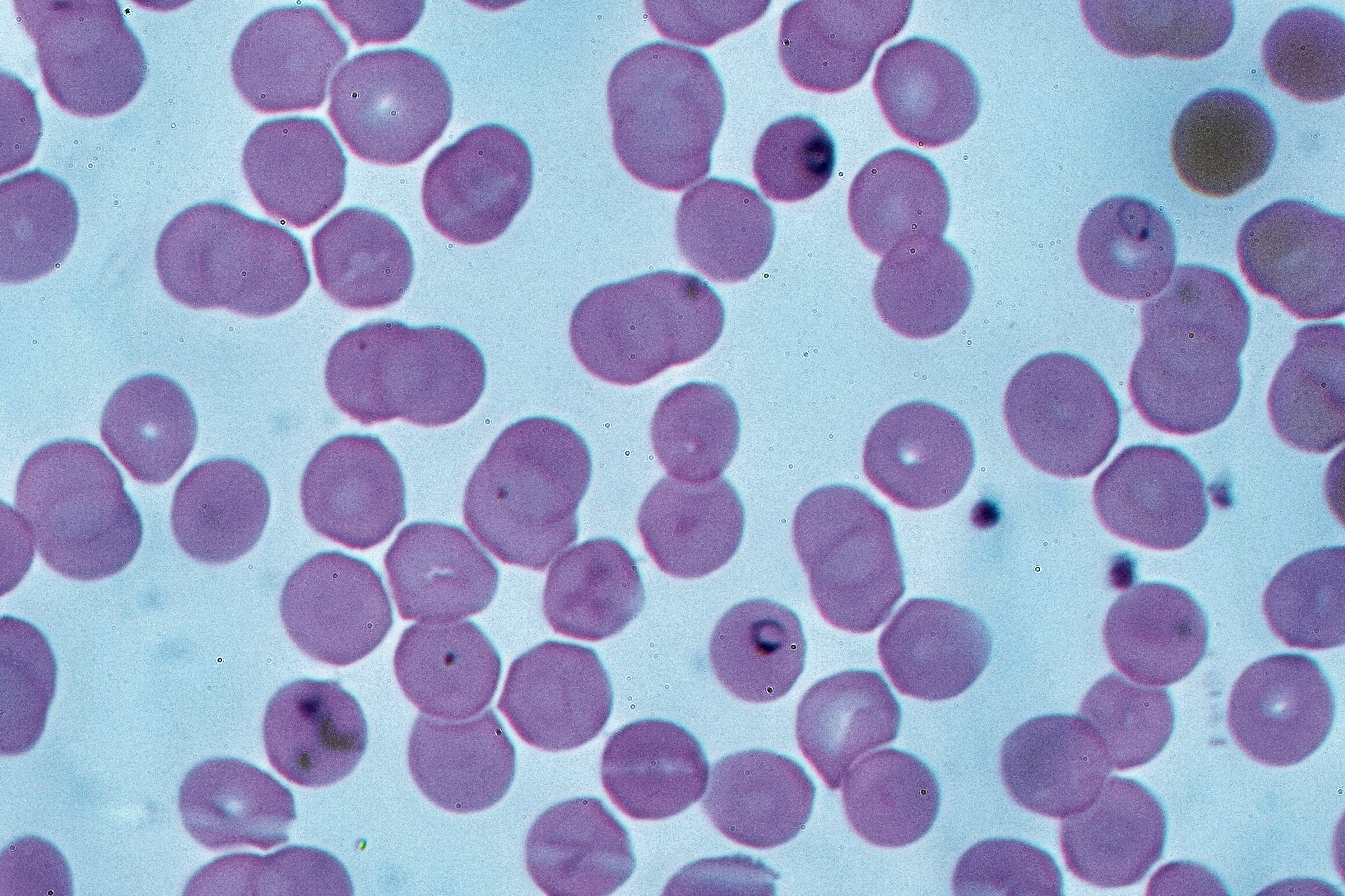 Plasmodium falciparum