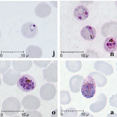 Plasmodium knowlesi