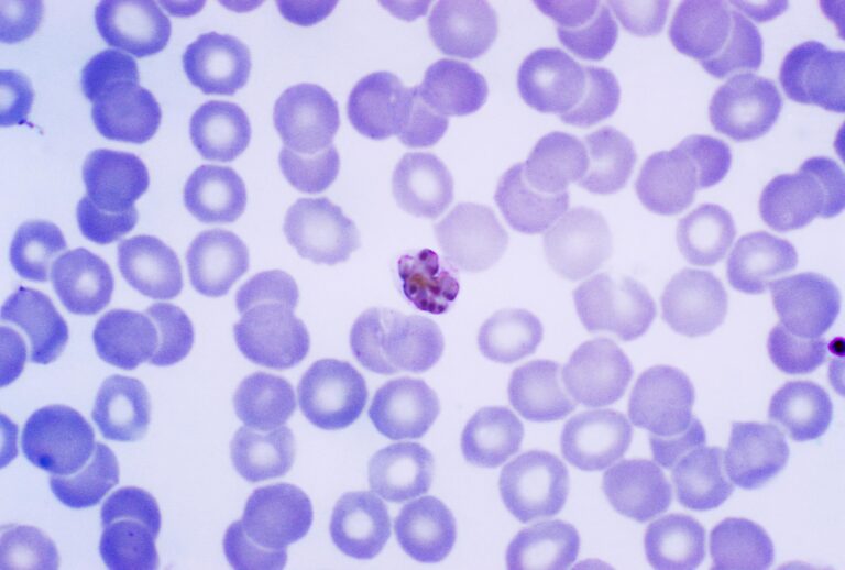 Plasmodium malariae