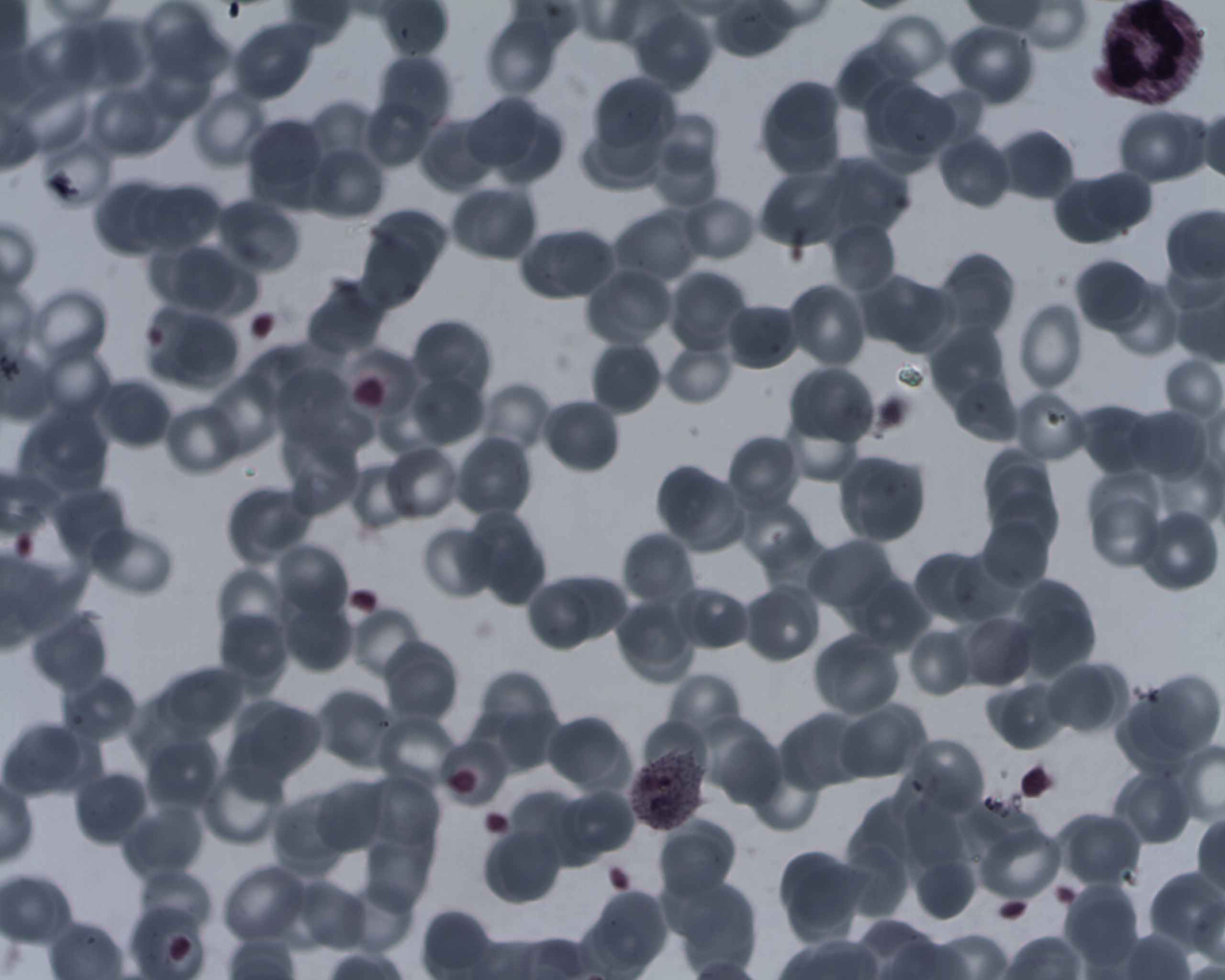 Plasmodium ovale