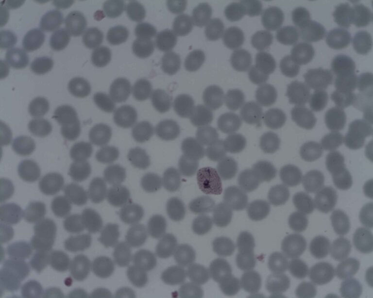 Plasmodium vivax Plasmodium vivax